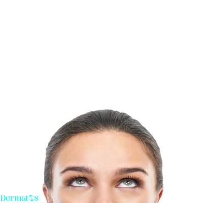 cause of dark circles under the eyes in women 2